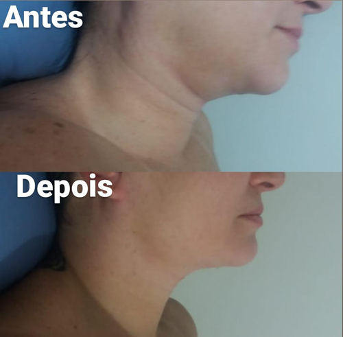 clinica de estetica em belo horizonte