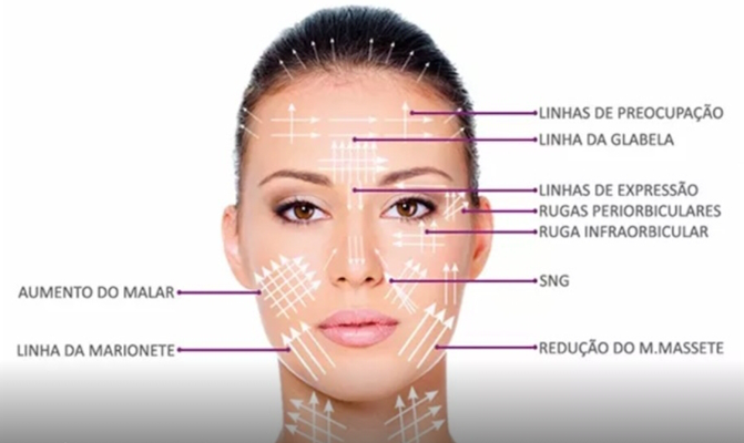 Harmonização Facial