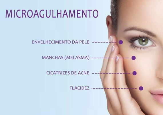 Harmonização Facial